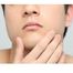 奈良でシミ治療。シミを改善する治療法５つ /男性専門美容外科ピュアメンズクリニック　奈良市西大寺奈良ファミリー前
